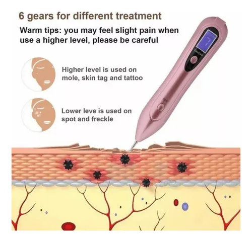 Cauterizador Láser Plasma Quita Verrugas