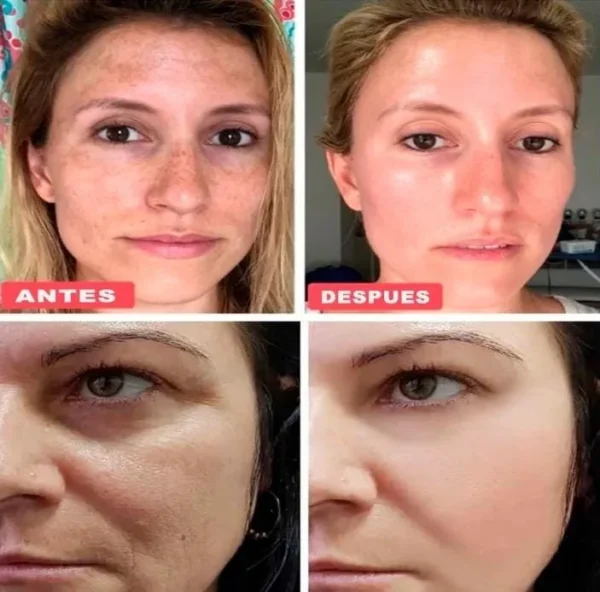 serum10-retinol-resultados Serum Retinol Repair Essence Serum10 Antiedad