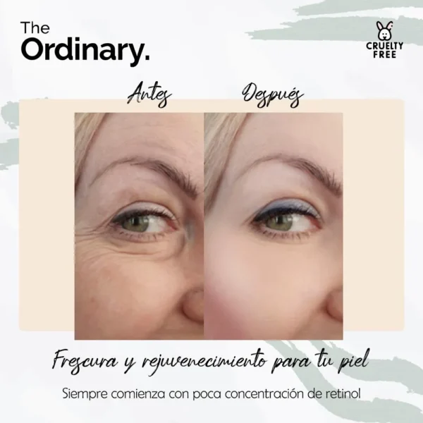 the-ordinary-retinol-05-en-squalane-original (2) Retinol The Ordinary 0.5% in Squalane